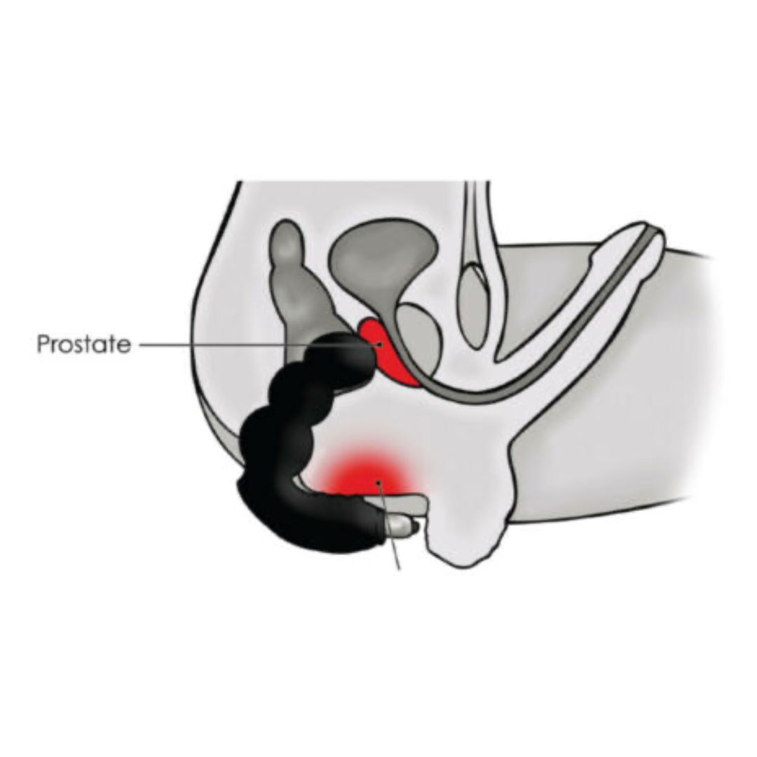 Vibruojantis prostatos masažuoklis „Naughty Boy