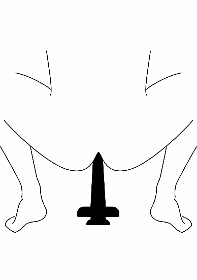 Analinis kaištis „Perfect Fit Brand The Boner 24,5 cm“  
Kam reikalingi analiniai kaiščiai? Kai kurie žmonės juos naudoja kaip analinio sekso apšilimo priemonę, kiti - kaip BDSM aksesuarą, o dar kiti - kad geriau susipažintų su analinių žaidimų pojūčiais. 
„Boner“ yra universalus gaminys, kuris gali būti įdedamas į „Hump Gear XL“ žaislą arba gali būti naudojamas kaip atskiras analinis dildo.  
Aksominis prisilietimas ir nesibaigiantys malonumai - tik šio analinio kaiščio pagalba. Iškilimai ir įdubimai veiksmingai masažuoja intymias vietas. Tai standartinis žaisliukas, tačiau svarbu paminėti, kad jis nesuderinamas su latekso gaminiais. 
Analinis kaištis  turi švelnų paviršių,  kad patirtumėte malonumą tiesiog lengvai įkišant ir ištraukiant. Platesnis pagrindas užtikrina apsaugą ir neleidžia kaiščiui pradingti jūsų kūne. 
  
24,5 cm ilgio ir 6,6 cm pločio žaisliukas  puikiai tinka tiek pradedantiesiems, tiek analinių žaidimų tyrinėtojams, tiek norint apšilti prieš audringą žaidimų naktį . Galite pasiekti visišką ekstazę be skausmo ir diskomforto. 
Tinkamai prižiūrint šis kaištis tarnaus jums ilgai. Prieš ir po kiekvieno naudojimo nuplaukite jį šiltu vandeniu ir švelniu muilu arba  specialiu žaislų valikliu . Leiskite išdžiūti natūraliai. Šį sekso žaislą laikykite stalčiuje, specialiame maišelyje arba kitoje vietoje, kurioje nėra dulkių. Laikykite jį atokiau nuo kitų sekso žaislų. Nepalikite tiesioginiuose saulės spinduliuose ir niekada nelaikykite jo dideliame karštyje. 
Rekomenduojama naudoti kartu su  vandens pagrindo lubrikantu . Nenaudokite silikoninių lubrikantų, aliejų ar kremų, nes jie gali sugadinti kaiščio medžiagą ir apriboti jo veikimą bei galiojimo laiką.  
 
